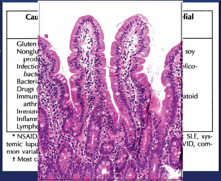 An increasing diagnostic problem with a wide