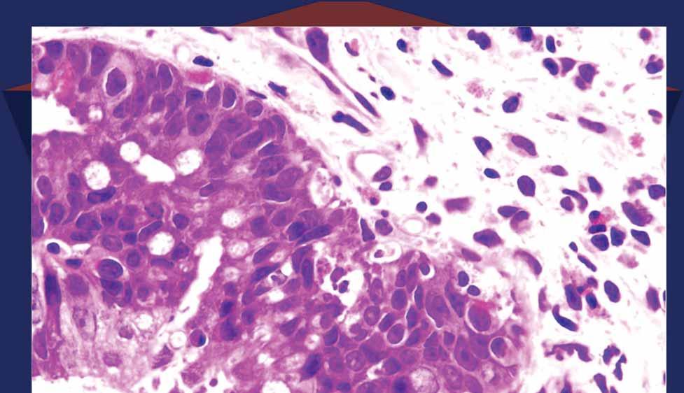 APOPTOTIC