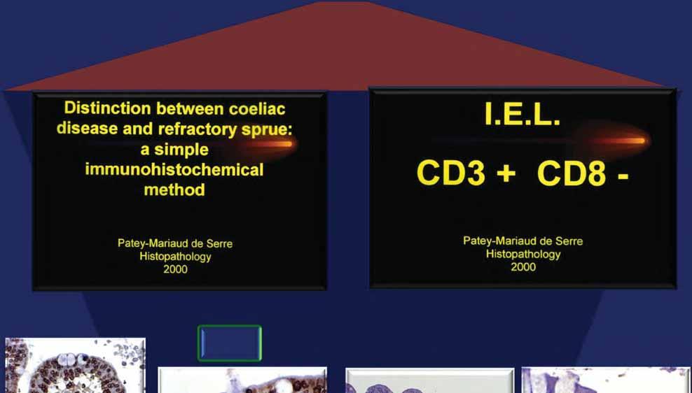 CD3 CD8