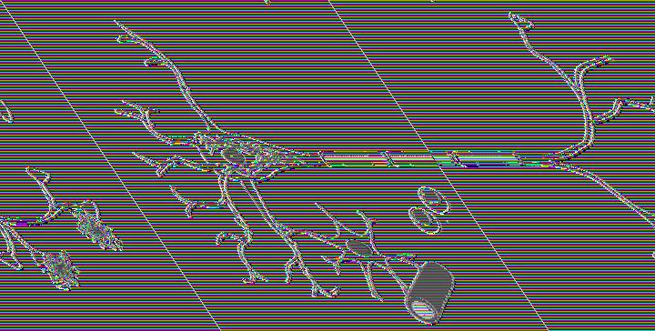 Neurofibrillay tangles Axon Senile plaq Figure 7. A neuron with AD pathology, i.e. intracellular neurofibrillary tangles (NFT) in the cytoplasm and extracellular deposits of senile plaques close to the synapses.