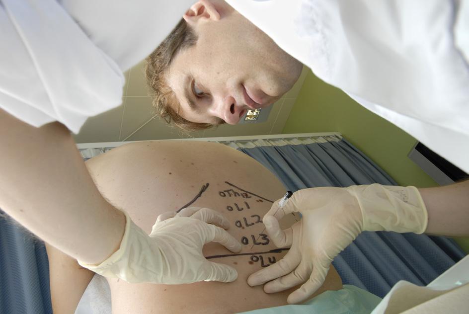 Figure 15 A. Lumbar puncture for CSF collection.