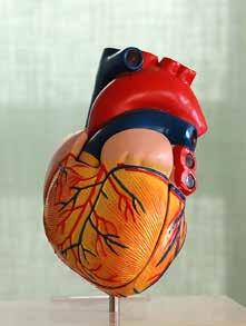 2 Kranskärlssjukdom Kranskärlssjukdom 3 Hjärtinfarkt Vid en hjärtinfarkt blir det akut stopp i ett kranskärl på grund av att en blodpropp bildas.