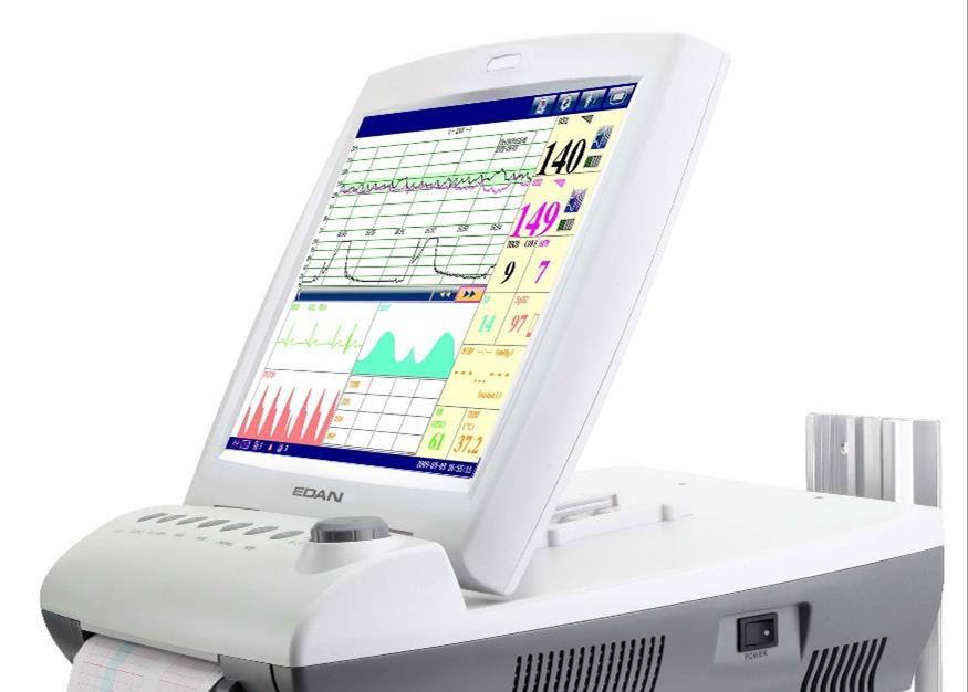 Datoriserad CTG-tolkning Dawes/Redman-kriterier, Oxford system, Sonicaid System 8000 Kriterier för normal NST kurva Normal basalfrekvens (mellan 116-160 spm) Minst en episod med normal variabilitet