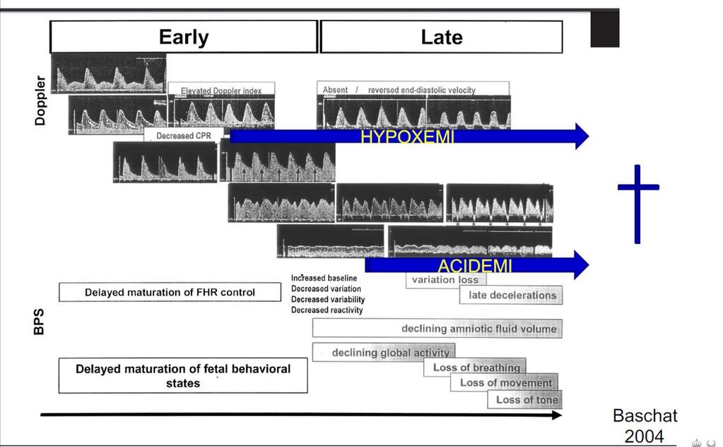 IUGR och prematuritet A Uterina A Umbilicalis A Cereb Media (MCA) Ductus Venosus