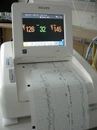 Prematuritet fungerar ctg?