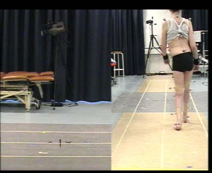 .. pathology alter[s] mobility,.