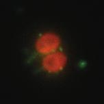 -Slp  -Slp Slp-Z Taq antigen