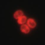 causes red autofluorescence;