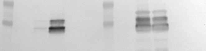 To evaluate how stable the PilA1- and Slp-based display systems were, the relative amounts of cell-attached and shed fusion proteins were analyzed by isolating protein fractions from the cell