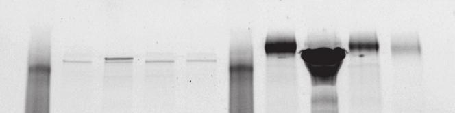 The reduced recovery of extractable pili for the PilA1-Z Taq strains, as compared to their background strains, indicates that incorporation of the fusion proteins negatively affected the pili,