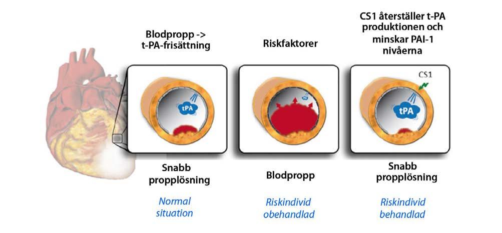 Cereno Scientific Hjärt- och kärlsjukdomar är idag den vanligaste dödsorsaken i världen.