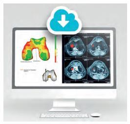 Skademarkeringsrapport Patientanpassning av Episealer med avseende på implantatens storlek (diameter och tjocklek) och kurvaturen av ledytan stöds genom skademarkeringsrapporten Epioscopy.