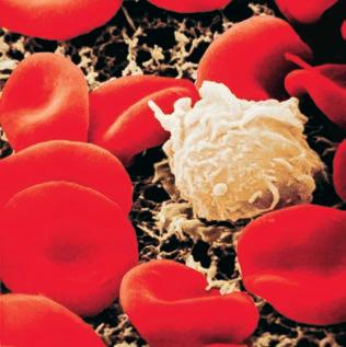 Kemoterapi och de vita blodkropparna i blodet Blodet består av blodplasma, röda blodkroppar, vita blodkroppar och blodplättar.