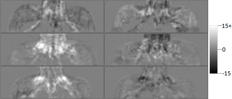 intervention. The image taken during room temperature has been registered against the image taken during cold stimulation.