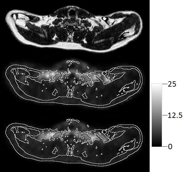 Figure 17. Neck images in the transverse plane of subject 2 during cold stimulation before the exercise intervention.