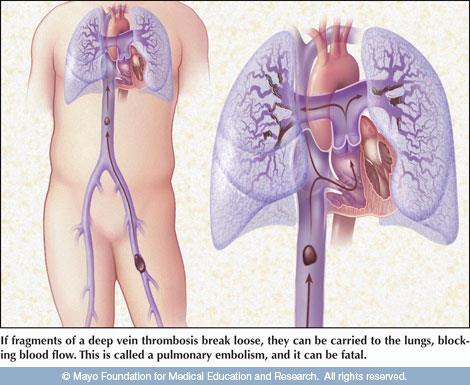 Lung