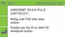 Majoriteten av resultaten Abnormt svag puls avser patienter med ankel-armindex (ABPI) runt eller lägre än 0,5.