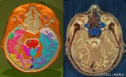 The Visible Human Project Segmentation of anatomical structures Indexing of