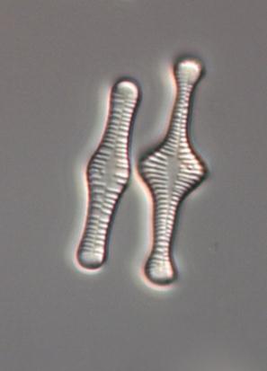 Brachysira neoexilis, Brachysira brebissonii, släktet Eunotia, Frustulia crassinervia, Frustulia erifuga, Peronia fibula (Figur 3) och Tabellaria