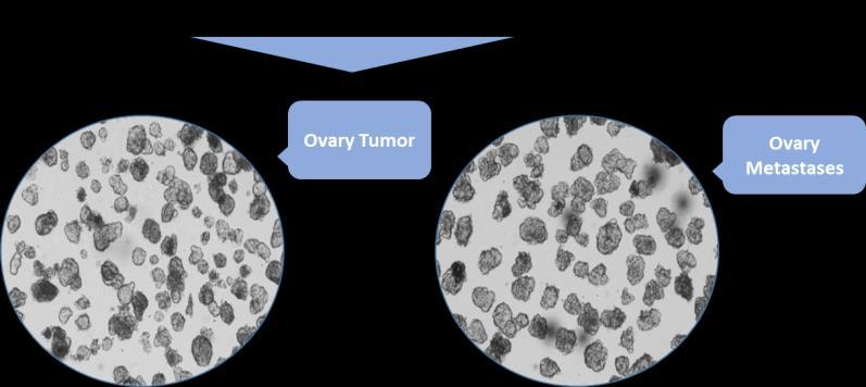 Hög känslighet innebär att behandlingen anses vara effektiv mot patientens cancertumör.