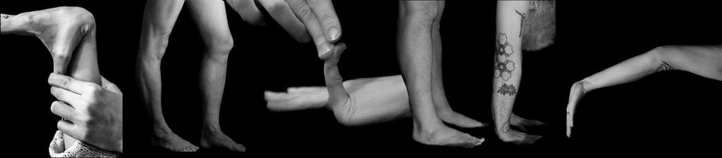 Vad är Ehlers-Danlos syndrom? Ehlers-Danlos syndrom (EDS) är en grupp ärftliga tillstånd som karaktäriseras av att bindväven har en förändrad struktur, vilket påverkar bl.a. hud, leder, ligament och blodkärl.