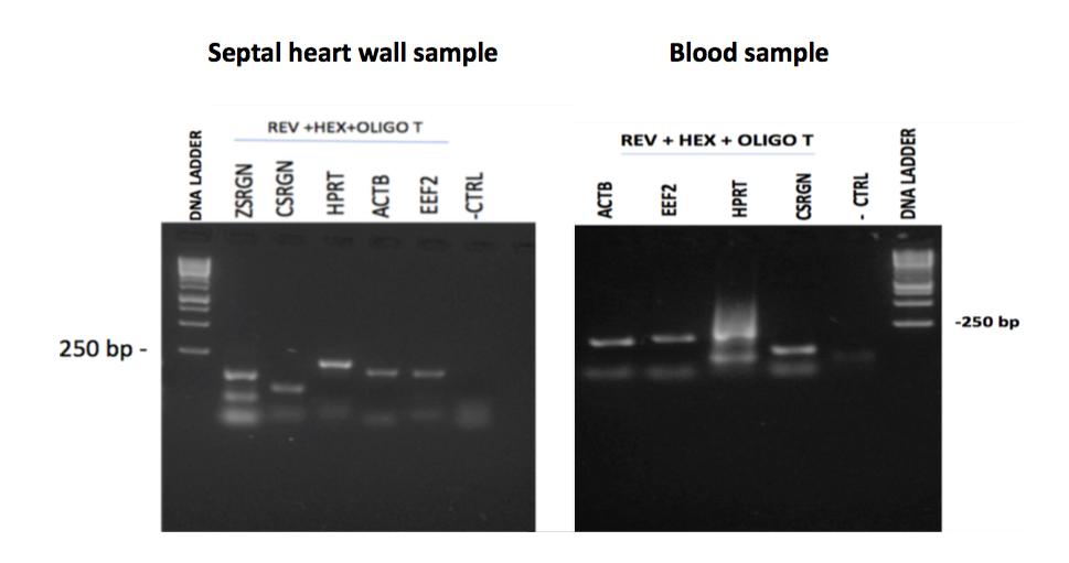 Figure 1. 2.5 % agarose gel analysis of the amplicons produced from the serglycin and four reference gene transcripts.