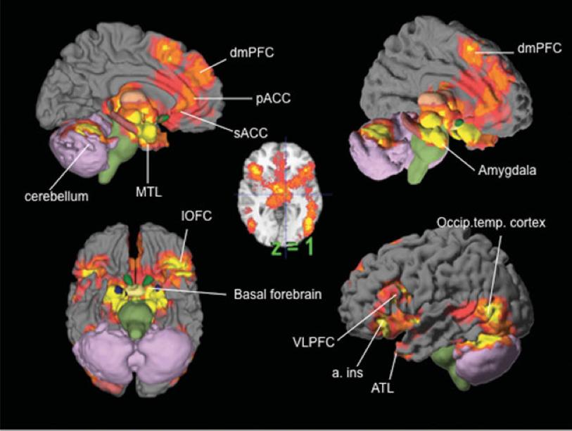 Funktionell selektivitet: Detta inträffar när neuroner visar en konsistent ökad aktivitet för ett mentalt tillstånd (ex ilska, emotion) eller basal psykologisk operation (ex kategorisering eller core