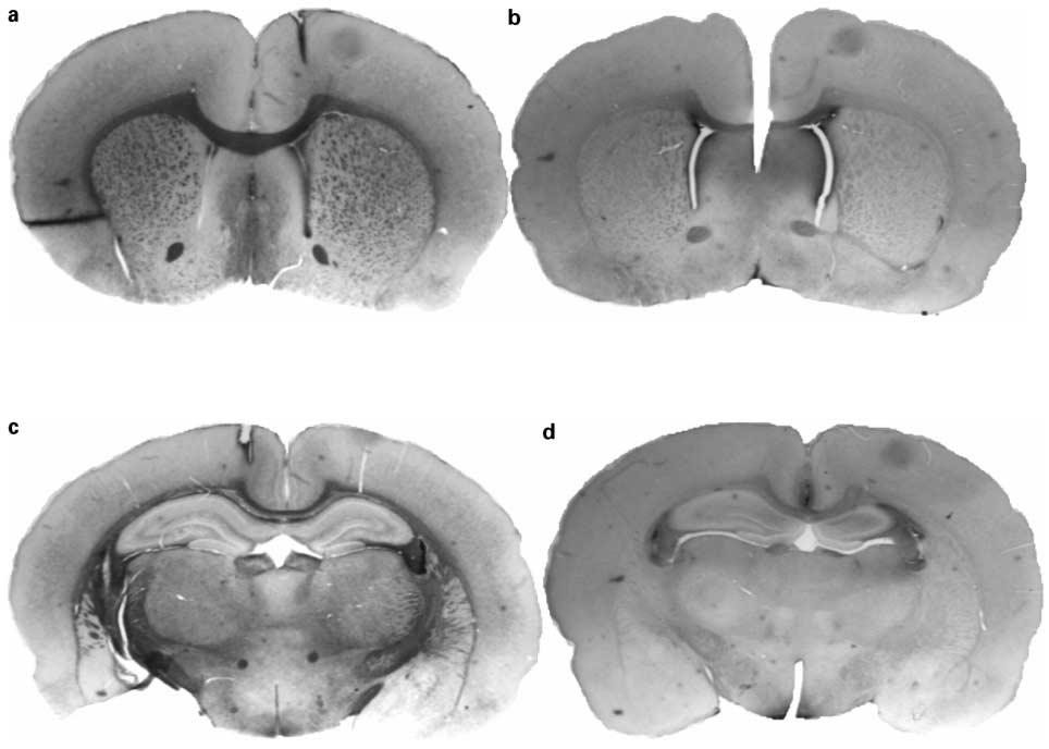 Exempel på djurforskning om järn och hjärna Påverkad myelinisering: Nervcellernas myelin hos råttor som haft