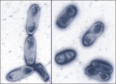 B-cell receptorn kan