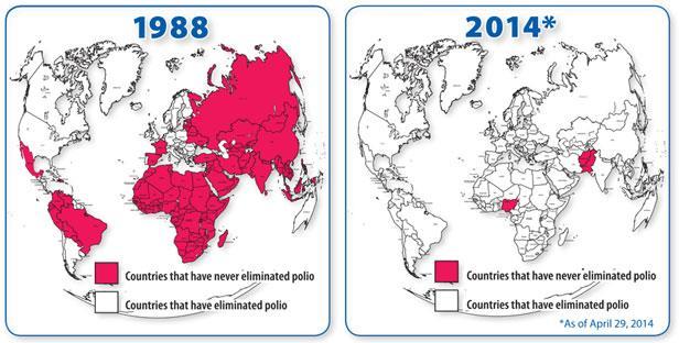 Polio Nästan utrotat, men utbrott i Syrien pga
