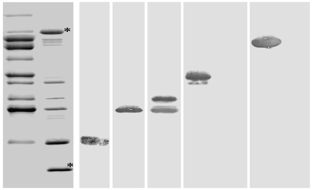 B. burgdorferi yttermembrane proteiner 1 2 2 2 2 1 2 1 2 Hsp 60