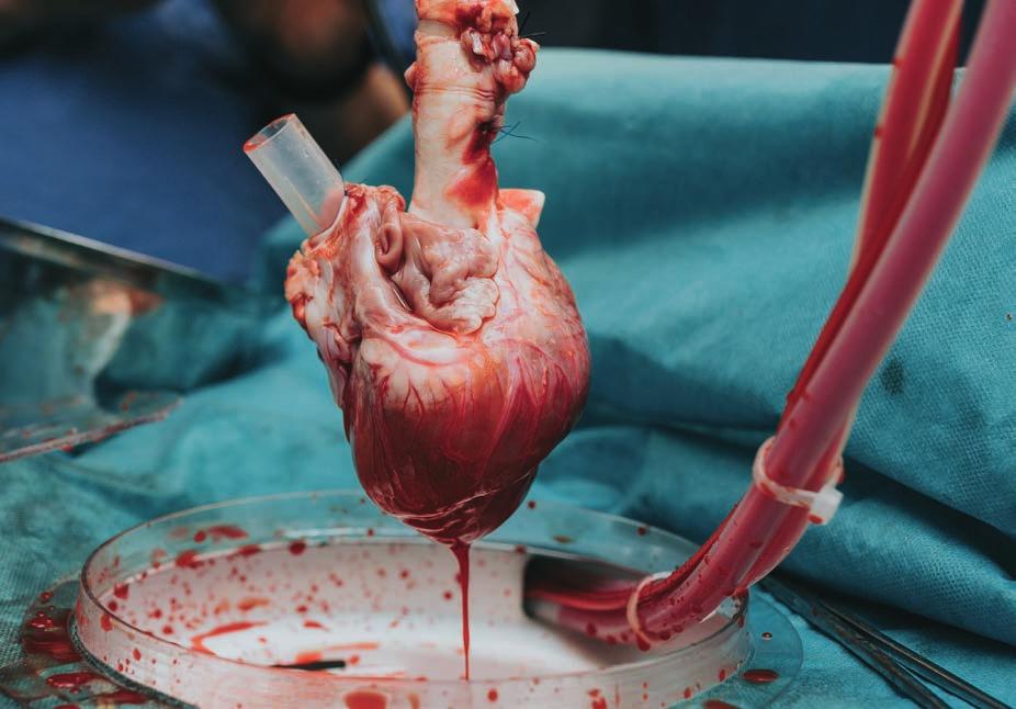MARKNAD, BEHANDLING OCH PRODUKTER Hjärttransplantation Den första hjärttransplantationen genomfördes 1967, men det var först under 80-talet som hjärttransplantation etablerades som metod.