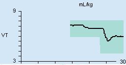 När du trycker på SVC-etCO2-parameterfältet öppnas sidan Trender/Data > SVC > Trend. Parameterfältet visar tiden (A) när ventilationsinställningarna senast ändrades av SVC.