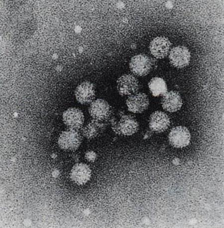Hepatit C Hepatit C virus