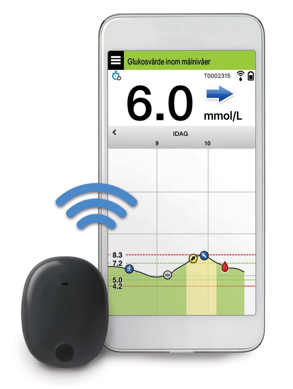 Snabbguide Eversense XL CGM-systemet inkluderar en sensor som sätts in i överarmen, en smartsändare som bärs över