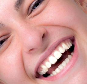 suprastrukturer veneers, inlays på and implantat, onlays.
