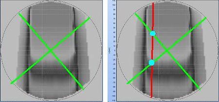 Figure 6. The image shows the variables used when the 3D absorbed dose distribution is calculated.