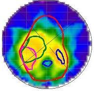 beam ray. Furthermore, DVHs are calculated using several regions of interest (ROIs) inside the Delta 4 phantom.