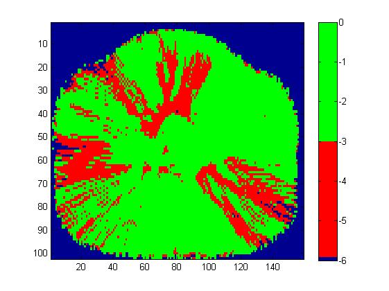 (a) Reference plan. The scale is in Gy. (b) The MLC bank shifted +1.0 mm. The scale is in Gy. (c) Percental absorbed dose difference. The scale is in %.