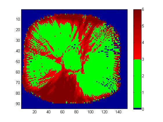 (a) Reference plan. The scale is in Gy. (b) The MLC bank shifted -1.0 mm. The scale is in Gy. (c) Percental absorbed dose difference. The scale is in %.