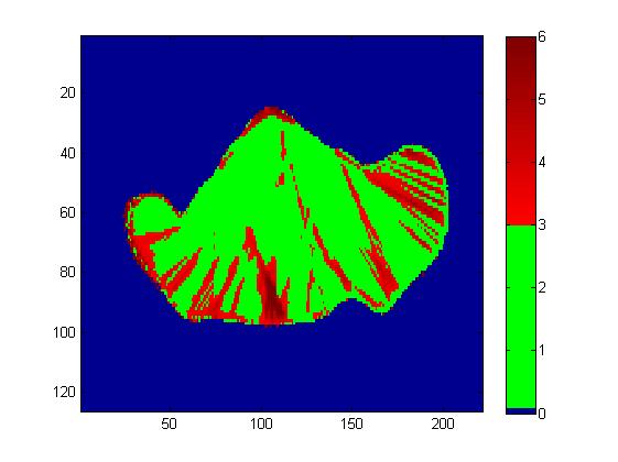(a) Reference plan. The scale is in Gy. (b) The MLC bank shifted -1.5 mm. The scale is in Gy. (c) Percental absorbed dose difference. The scale is in %.
