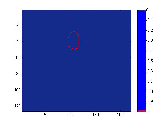 (a) Reference plan (b) The MLC bank shifted -1.5mm (c) The volume difference between reference plan and the MLC bank shifted -1.5 mm Figure 22. Figures (a), (b) and (c) shows the volume in cm 3.