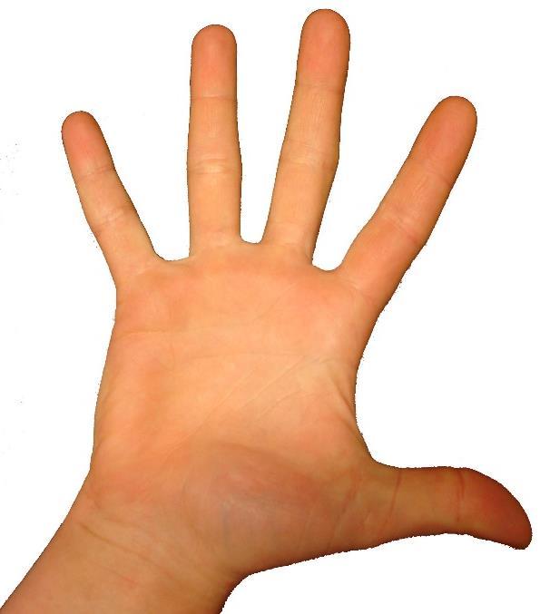 Trauma/olycksfall E 9 EXTREMITETSSKADOR Handskador med utslagen cirkulation där replantation ej är aktuell, dvs amputation av enstaka finger på dig II-V hos vuxna samt fingertoppskador.