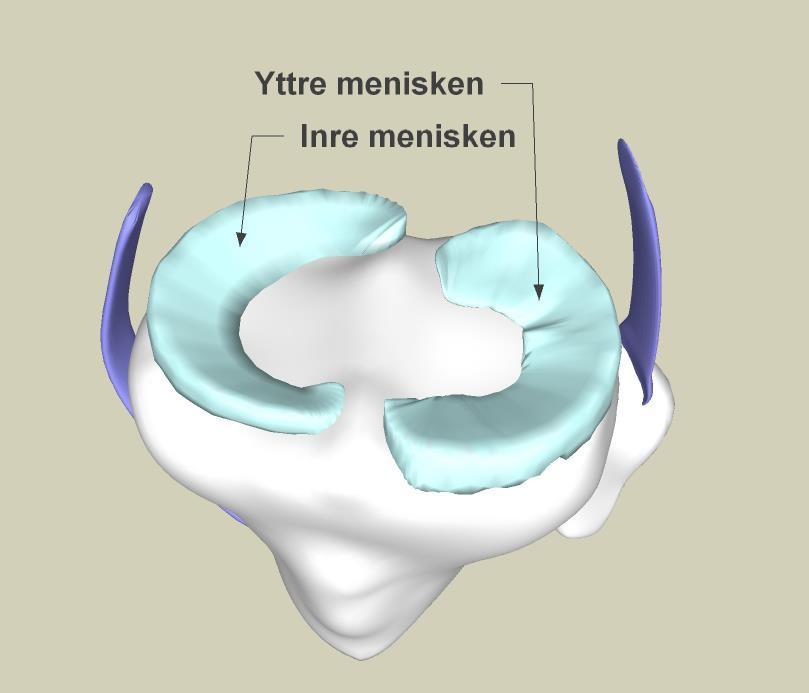Vad är menisker? Meniskerna är halvmåneformade broskskivor som sitter i knäledens inre och yttre kammare.