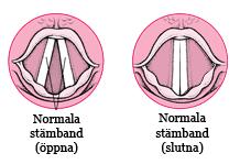 Stämbanden Din röst fungerar med hjälp av stämbanden När du talar vibrerar stämbanden