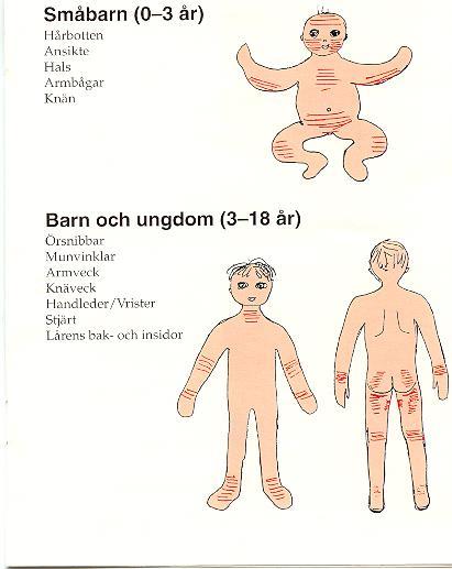 Skolåldern 12% Ansikte, bål och sträcksidor.