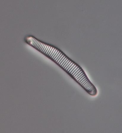 Achnanthidium minutissimum är ofta vanlig i näringsfattiga till måttligt näringsrika vatten, förutom i sura miljöer.