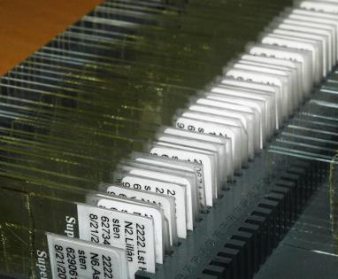 stenar eller växter) och spelar en viktig roll som primärproducenter, särskilt i rinnande vatten.