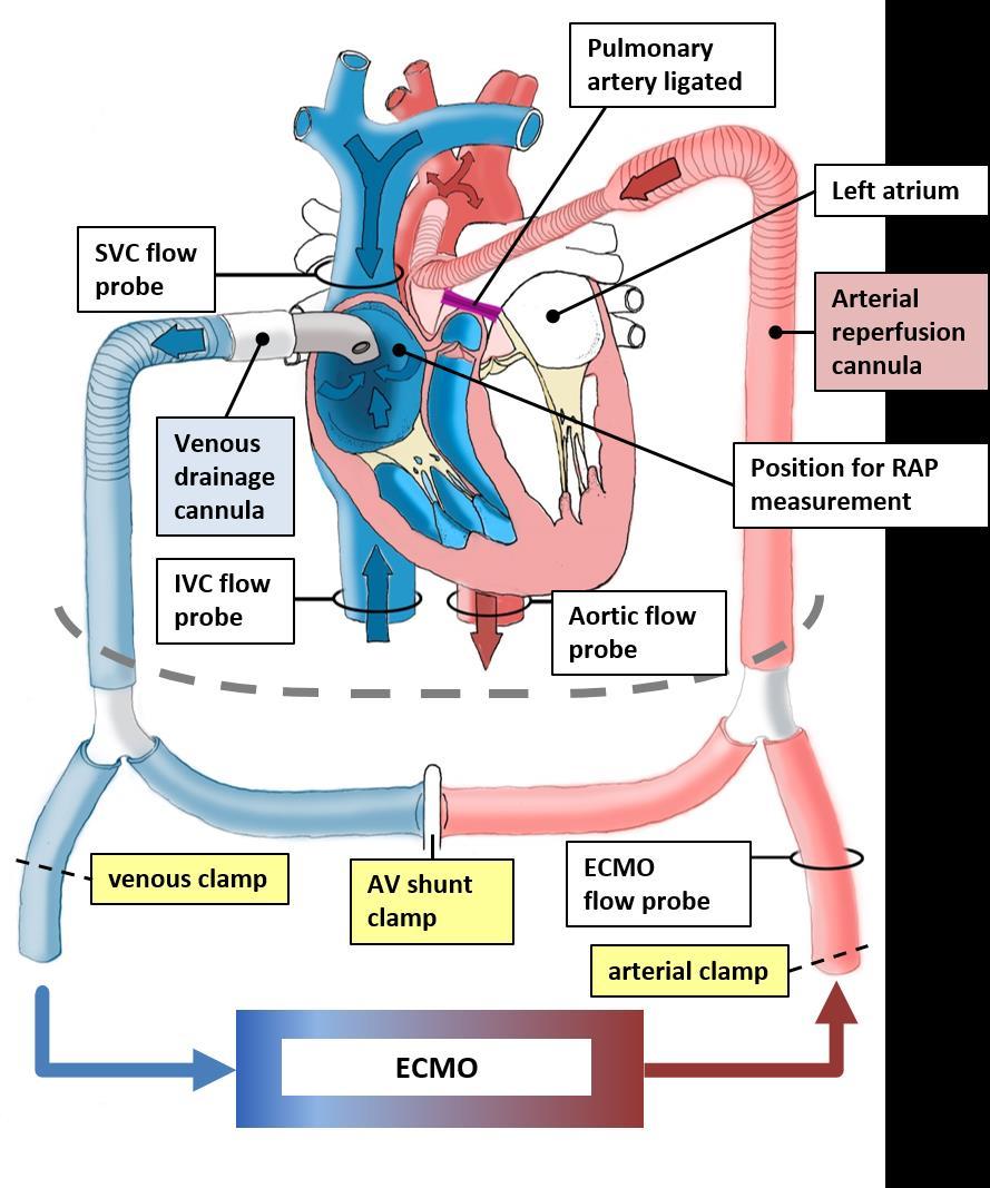 Mean systemic filling pressure Figure 16 Extracorporeal membrane oxygenation (ECMO) circuit used in Paper II, including cannulas, arteriovenous (AV) shunt, and sites for flowprobes and RAP