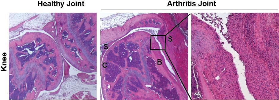 to activate immune cells to produce cytokines, self-reactive antibodies and matrix metalloproteases (MMPs), causing the synovium to expand and this process goes hand-in-hand with to joint destruction